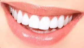 Oferim si servicii stomatologice de urgenta. Dr. Graur Romeo Iași Beneficii Albirea Dentară
